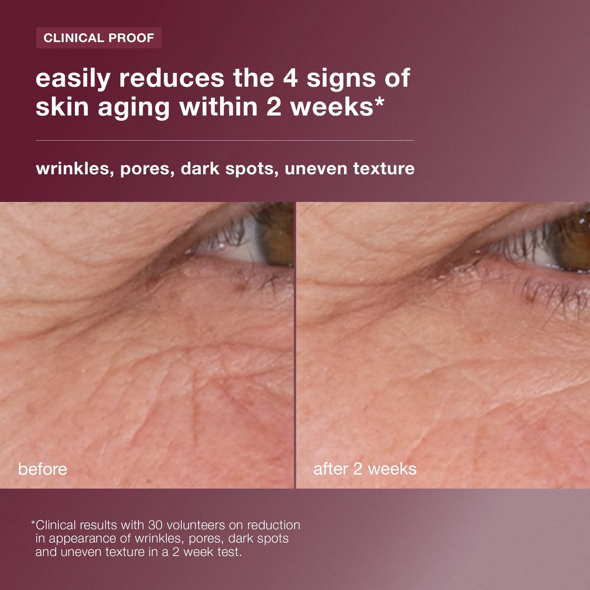 Dynamic Skin Retinol Serum 1oz